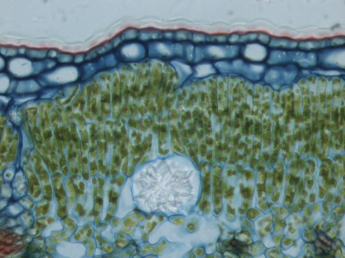 Idioblast